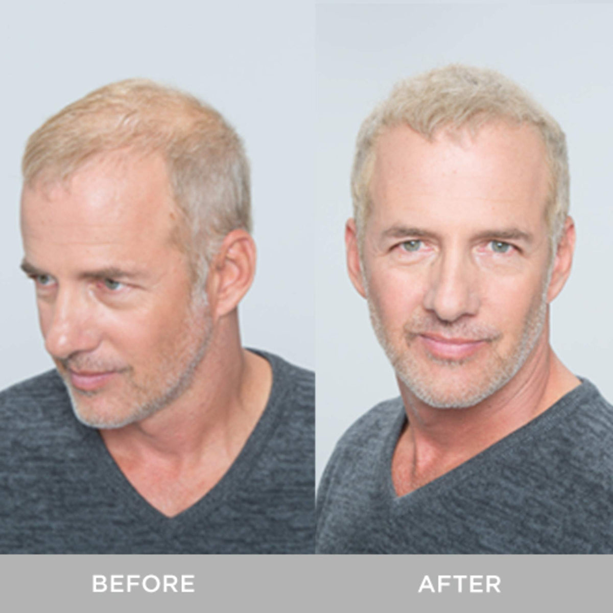 Before and after of a man's thinning blond hair filled in with fibers