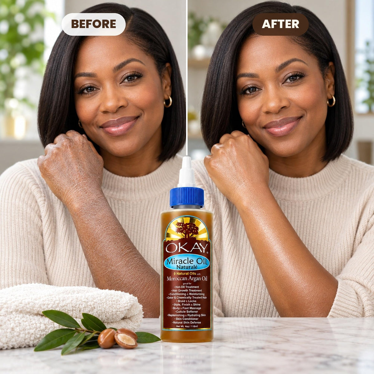Before and after of dry then moisturised skin on a forearm, with the Miracle Oil bottle
