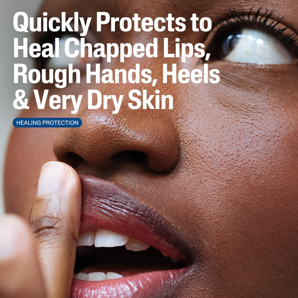 Close-up of a woman touching her lips, healing ointment for chapped lips