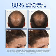 Load image into Gallery viewer, BosleyMD BosRevive Volumizing Conditioner for Noticeably Thinning and Non Color Treated Hair, Liter, 33.8 Fl Oz
